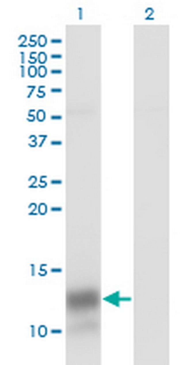 PF4 Antibody in Western Blot (WB)