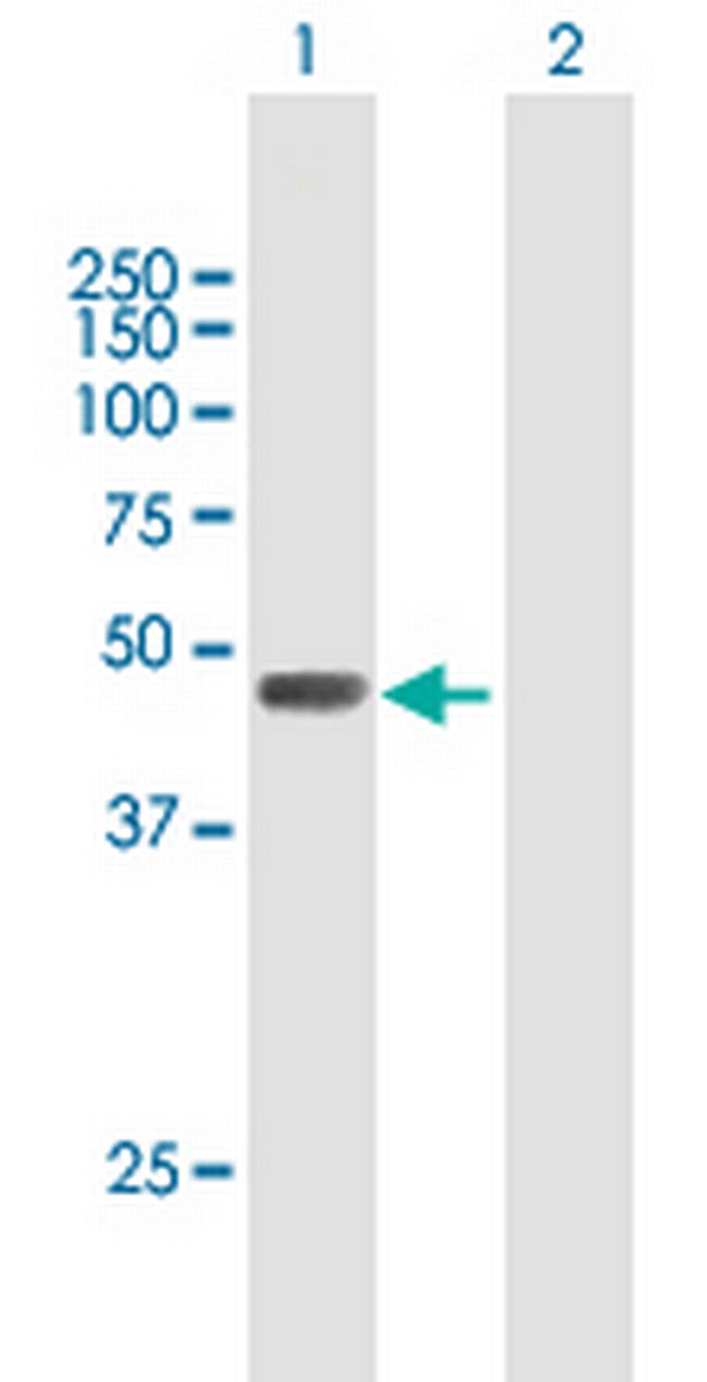 CFP Antibody in Western Blot (WB)