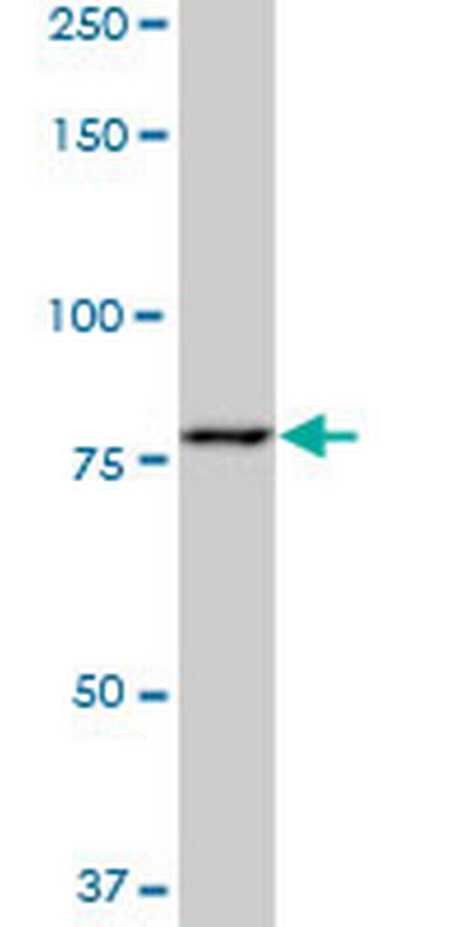 PFKM Antibody in Western Blot (WB)