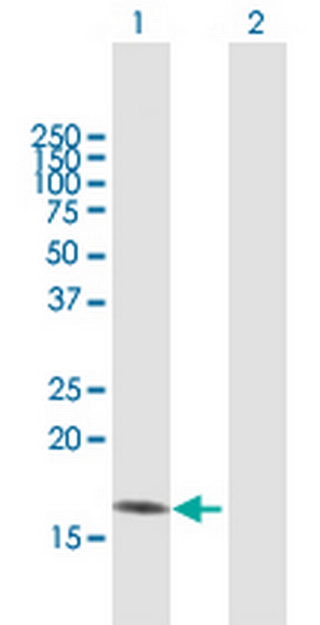 PFN1 Antibody in Western Blot (WB)