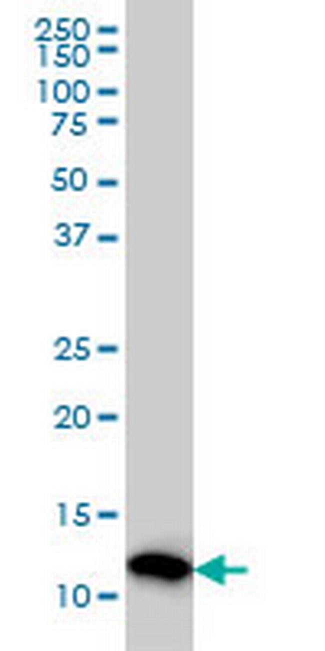 PFN2 Antibody in Western Blot (WB)