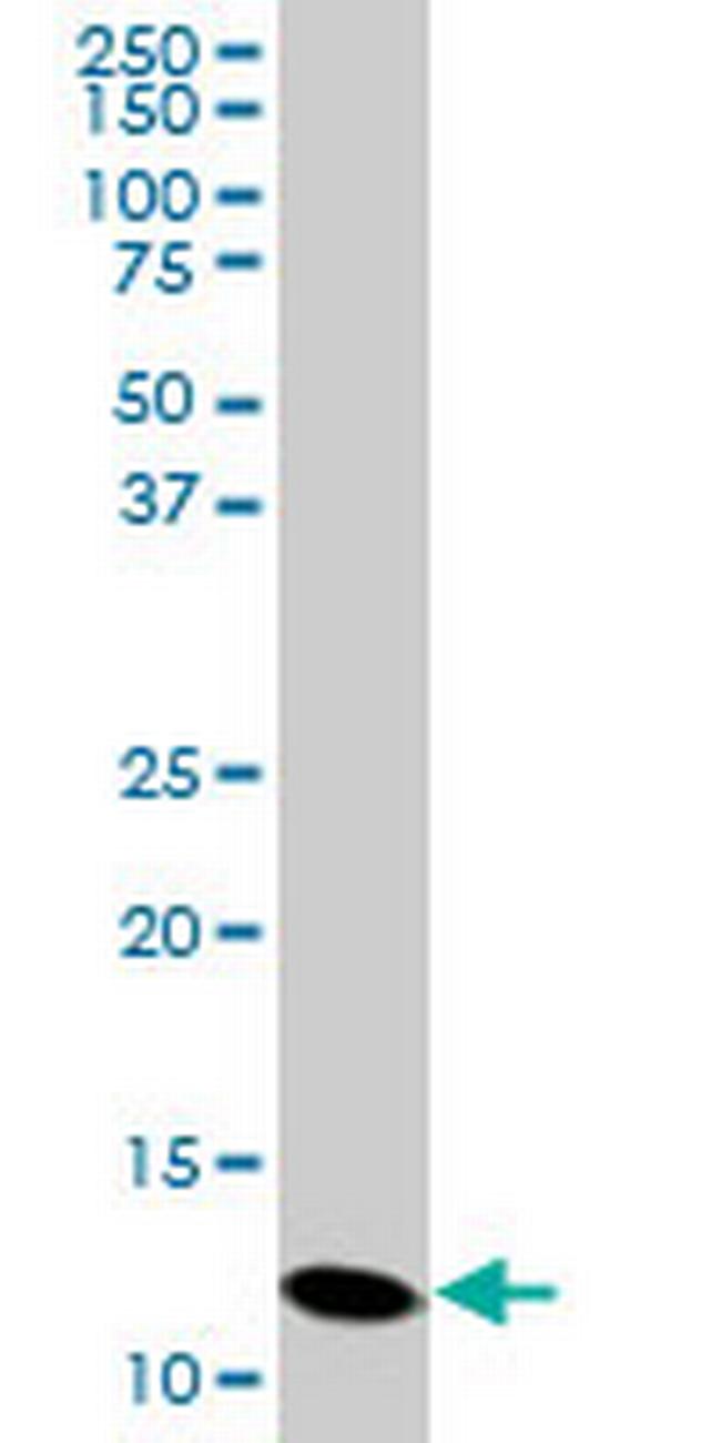 PFN2 Antibody in Western Blot (WB)