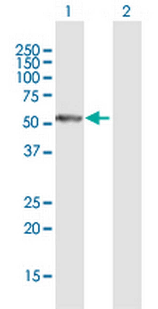 PFTK1 Antibody in Western Blot (WB)