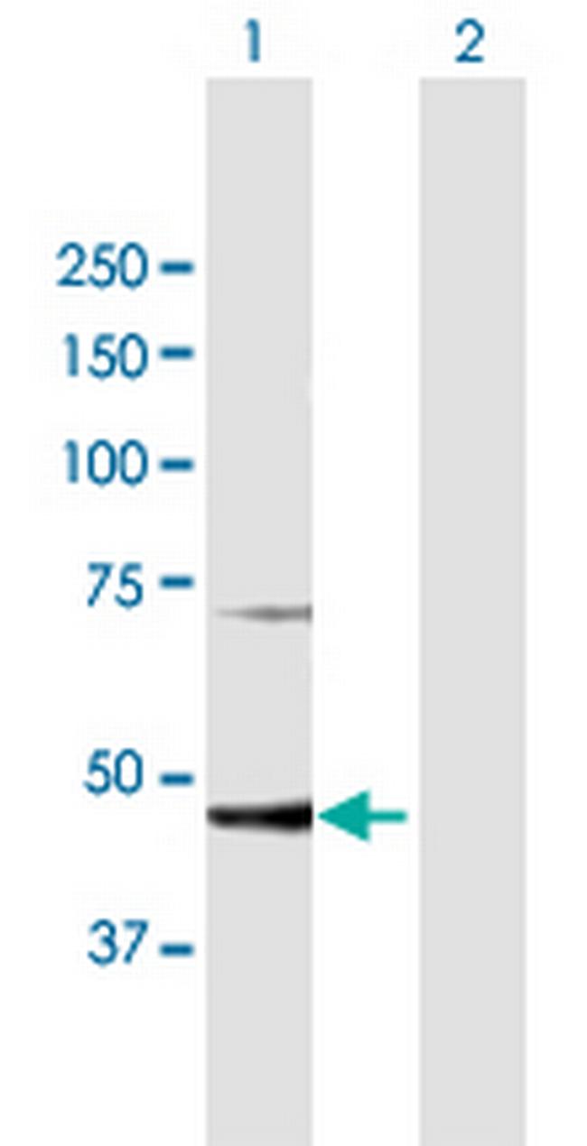 PGD Antibody in Western Blot (WB)