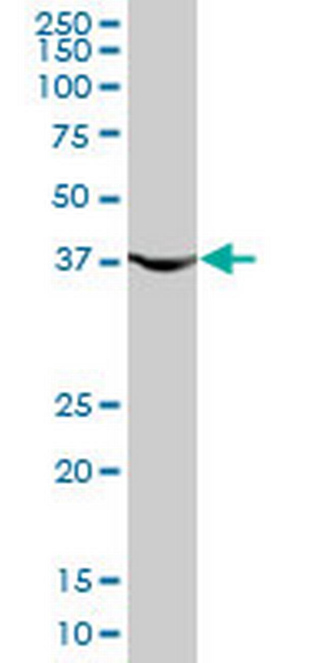 PGK1 Antibody in Western Blot (WB)