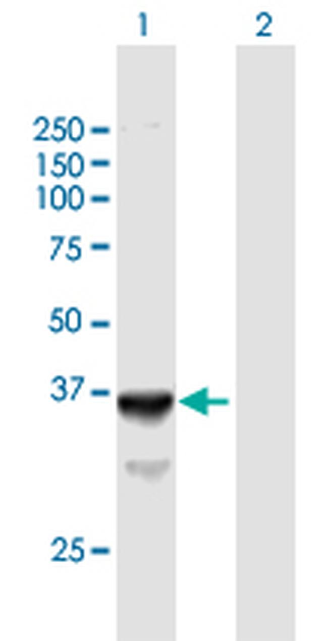 SLC25A3 Antibody in Western Blot (WB)