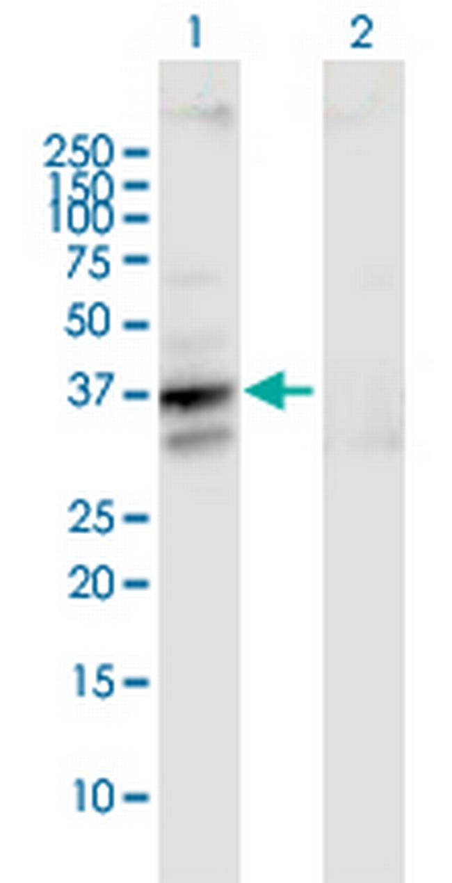 SLC25A3 Antibody in Western Blot (WB)