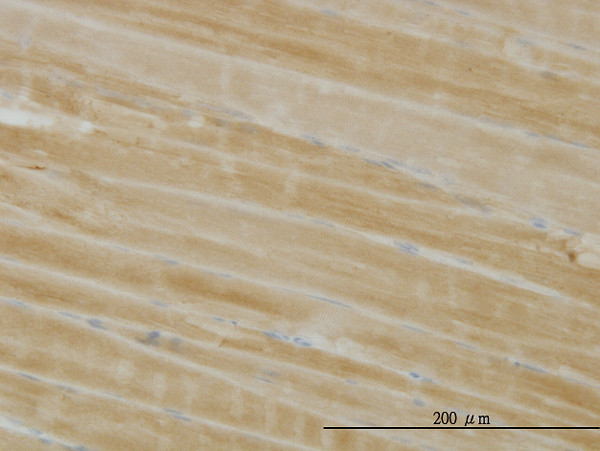 PHKG1 Antibody in Immunohistochemistry (Paraffin) (IHC (P))