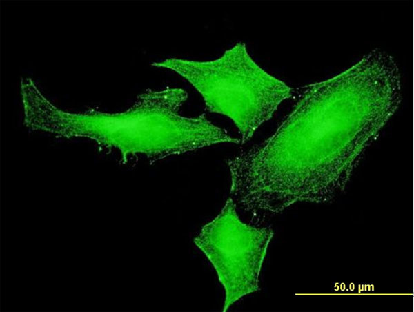 PIM1 Antibody in Immunocytochemistry (ICC/IF)