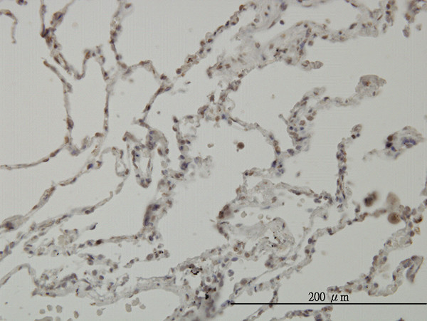 PIM1 Antibody in Immunohistochemistry (Paraffin) (IHC (P))