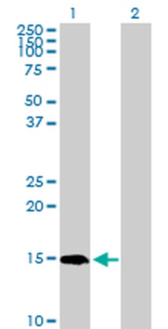 PIN4 Antibody in Western Blot (WB)