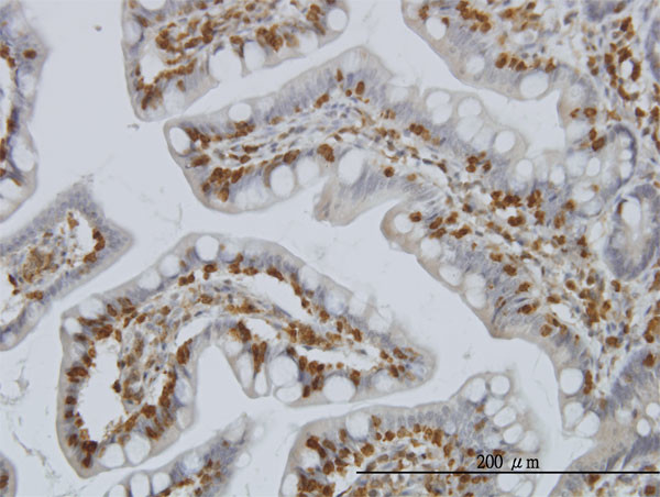 PIP5K2A Antibody in Immunohistochemistry (Paraffin) (IHC (P))