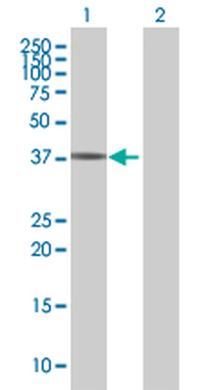 PITX1 Antibody in Western Blot (WB)