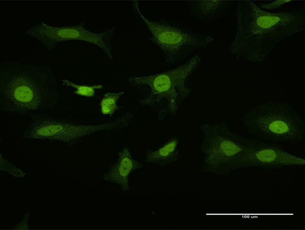 PITX1 Antibody in Immunocytochemistry (ICC/IF)