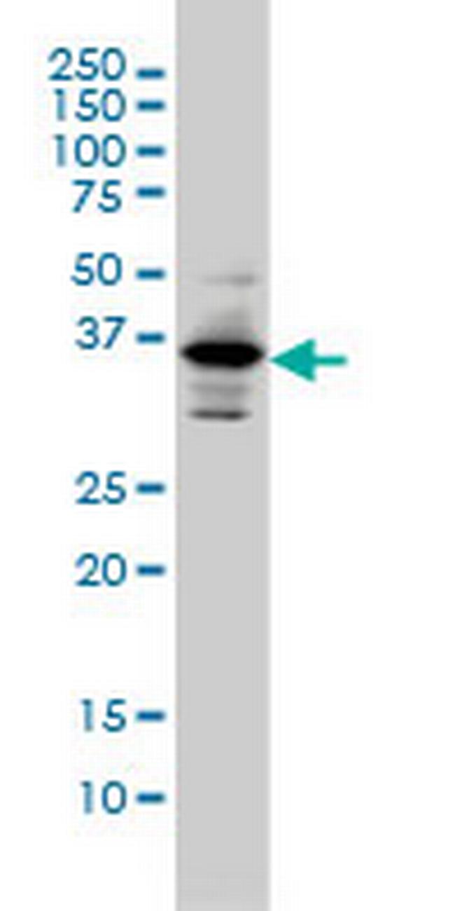 PITX1 Antibody in Western Blot (WB)