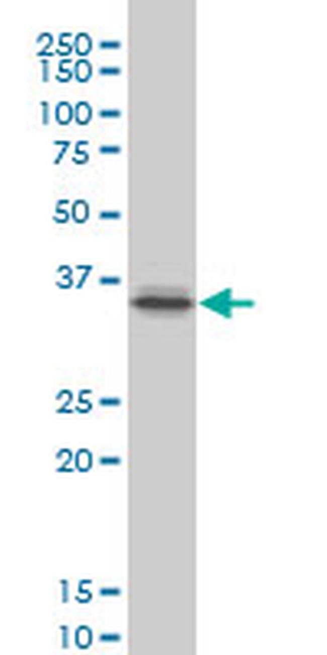 PITX1 Antibody in Western Blot (WB)