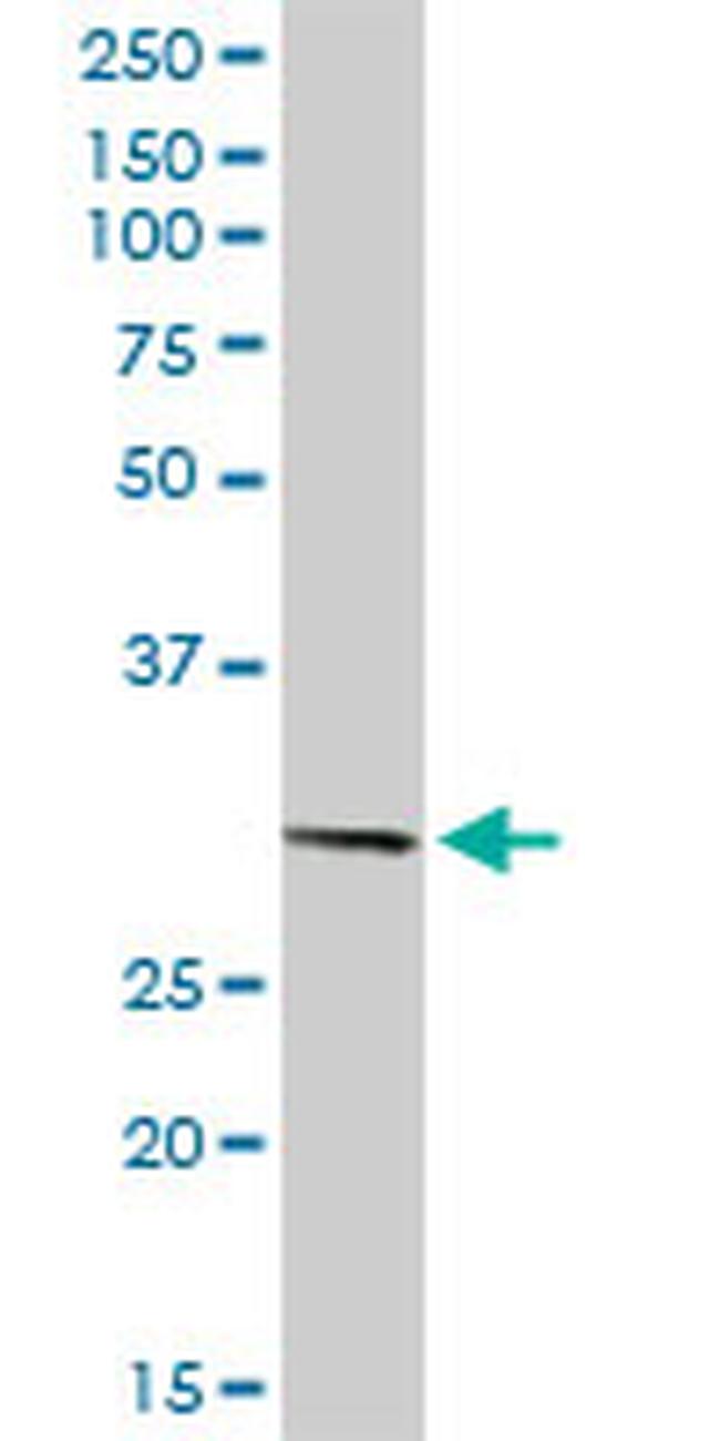 PITX2 Antibody in Western Blot (WB)