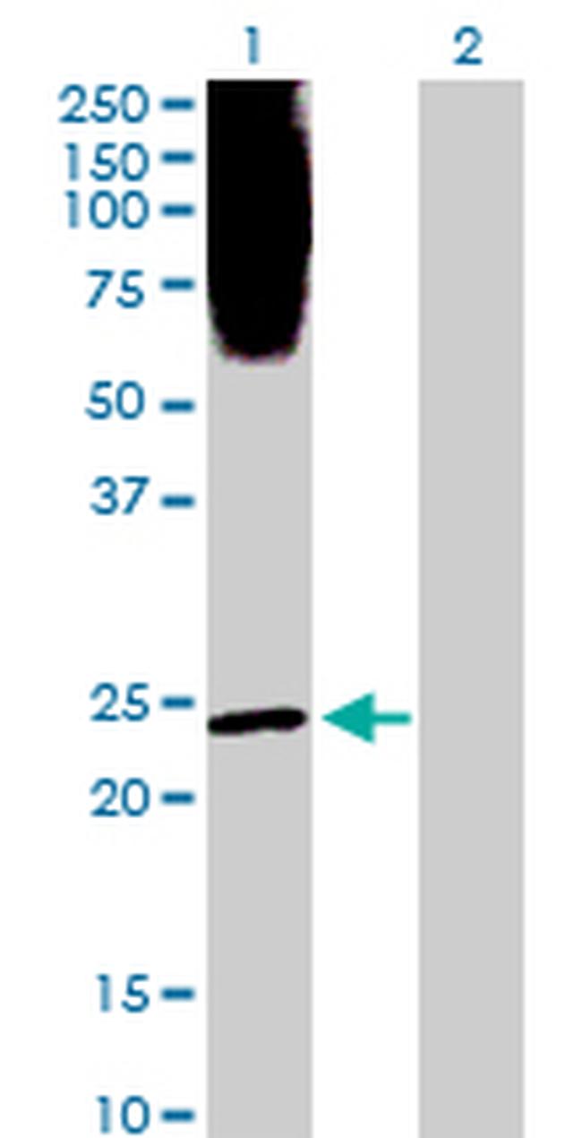 PLA2G1B Antibody in Western Blot (WB)