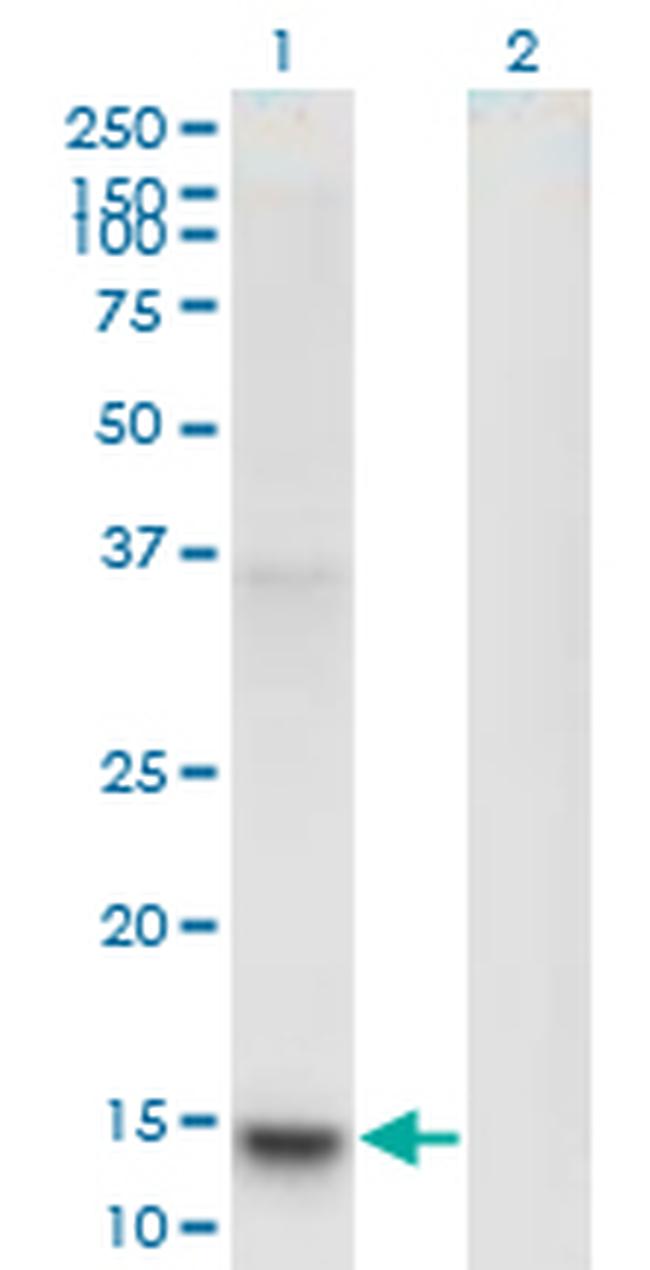 PLA2G1B Antibody in Western Blot (WB)