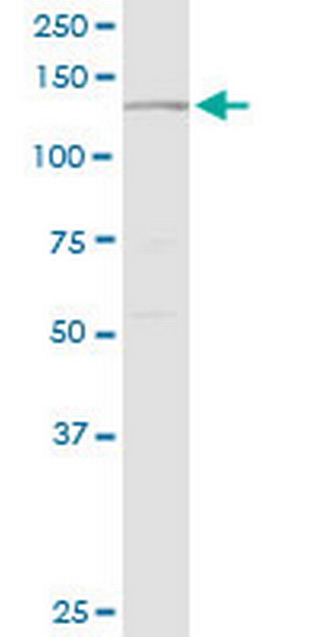 PLCG2 Antibody in Western Blot (WB)