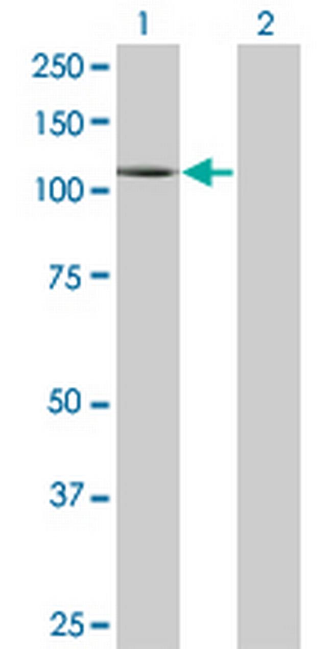 PLD1 Antibody in Western Blot (WB)