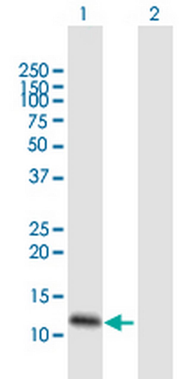 FXYD3 Antibody in Western Blot (WB)