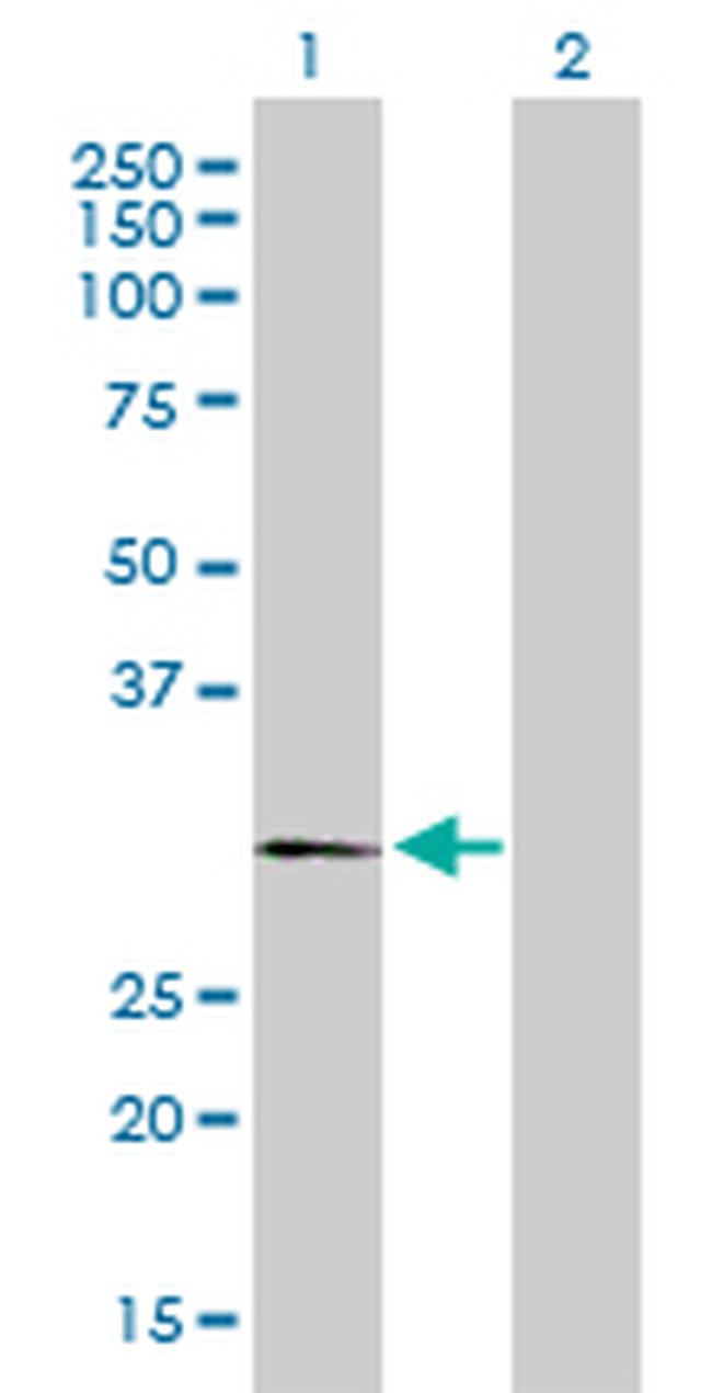 PLP1 Antibody in Western Blot (WB)