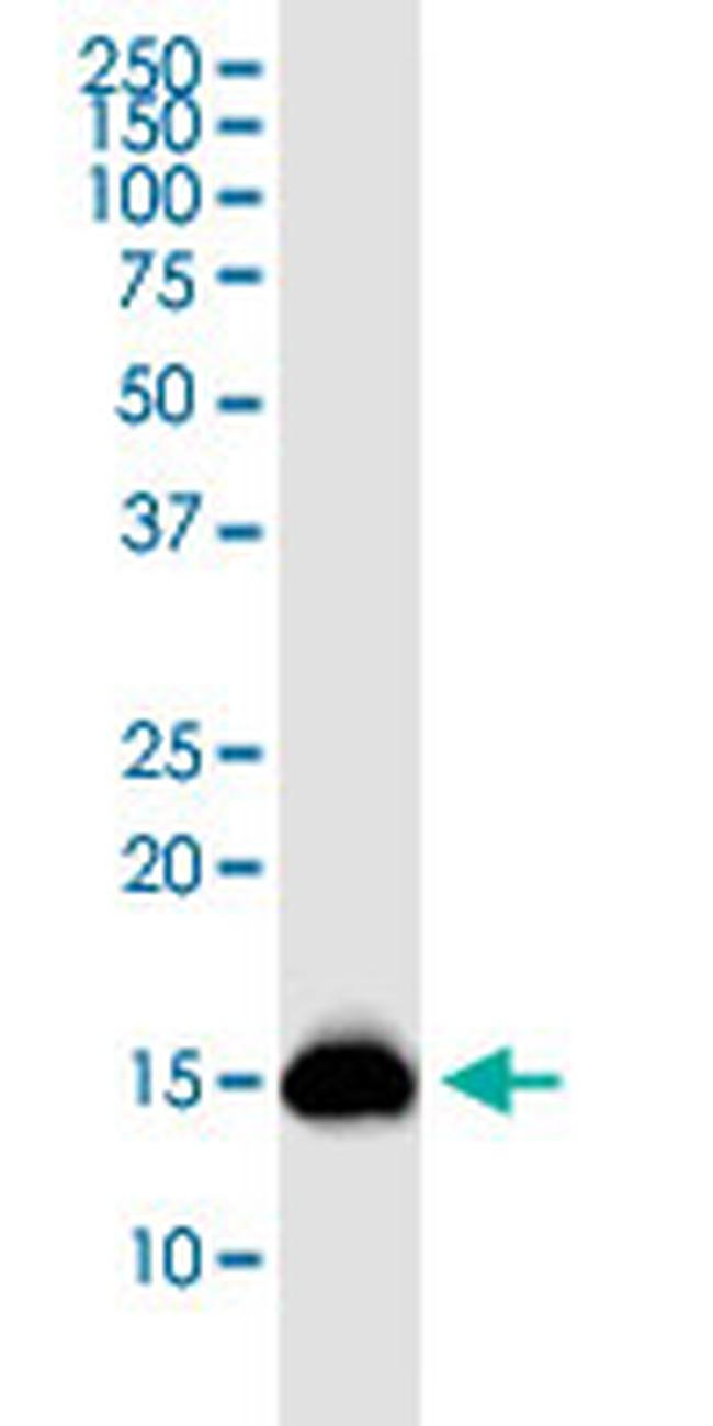 PLP2 Antibody in Western Blot (WB)