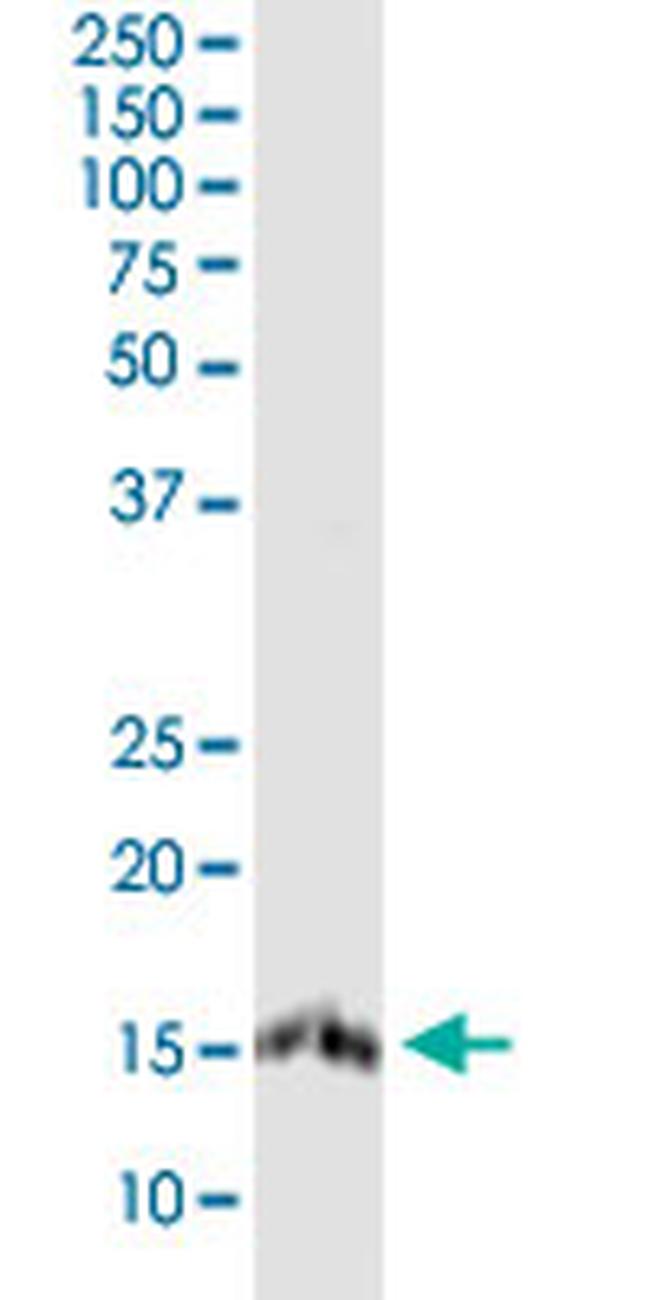 PLP2 Antibody in Western Blot (WB)