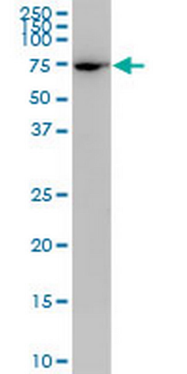 PLS1 Antibody in Western Blot (WB)