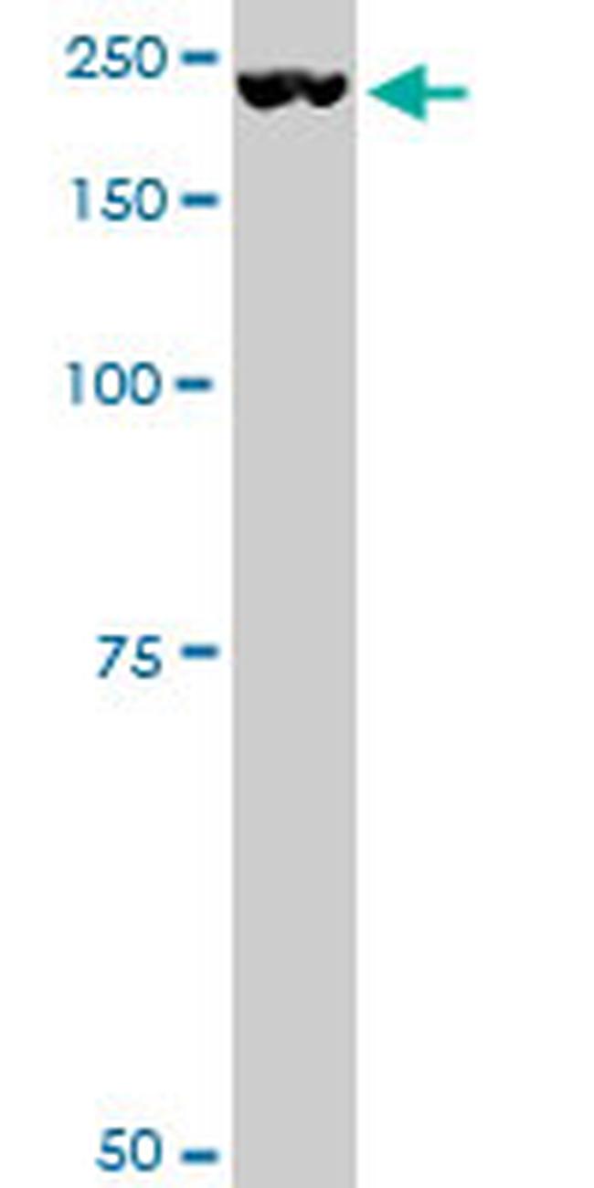 PLXNA2 Antibody in Western Blot (WB)