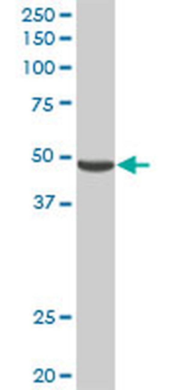 PNLIPRP2 Antibody in Western Blot (WB)