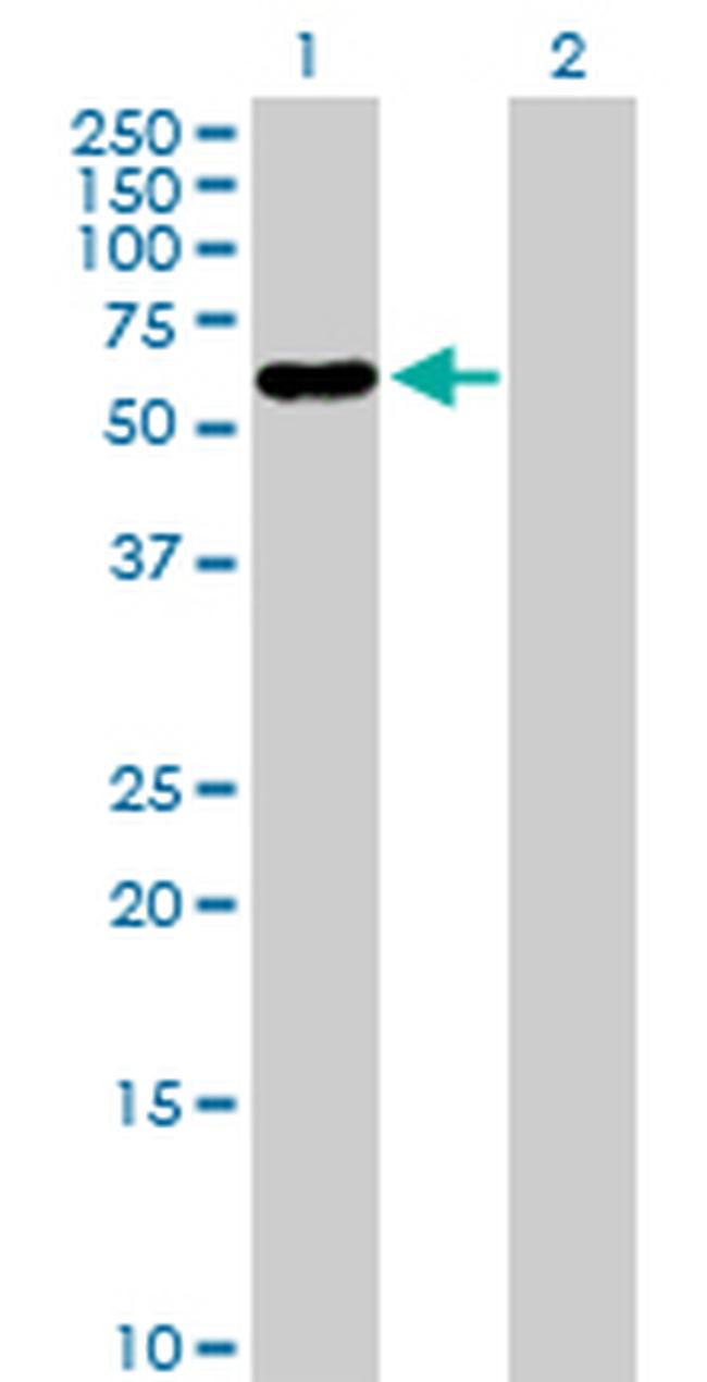 PNLIPRP2 Antibody in Western Blot (WB)