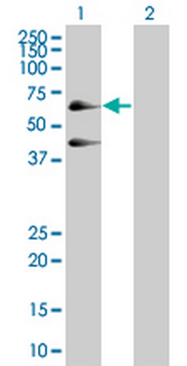 SEPT4 Antibody in Western Blot (WB)