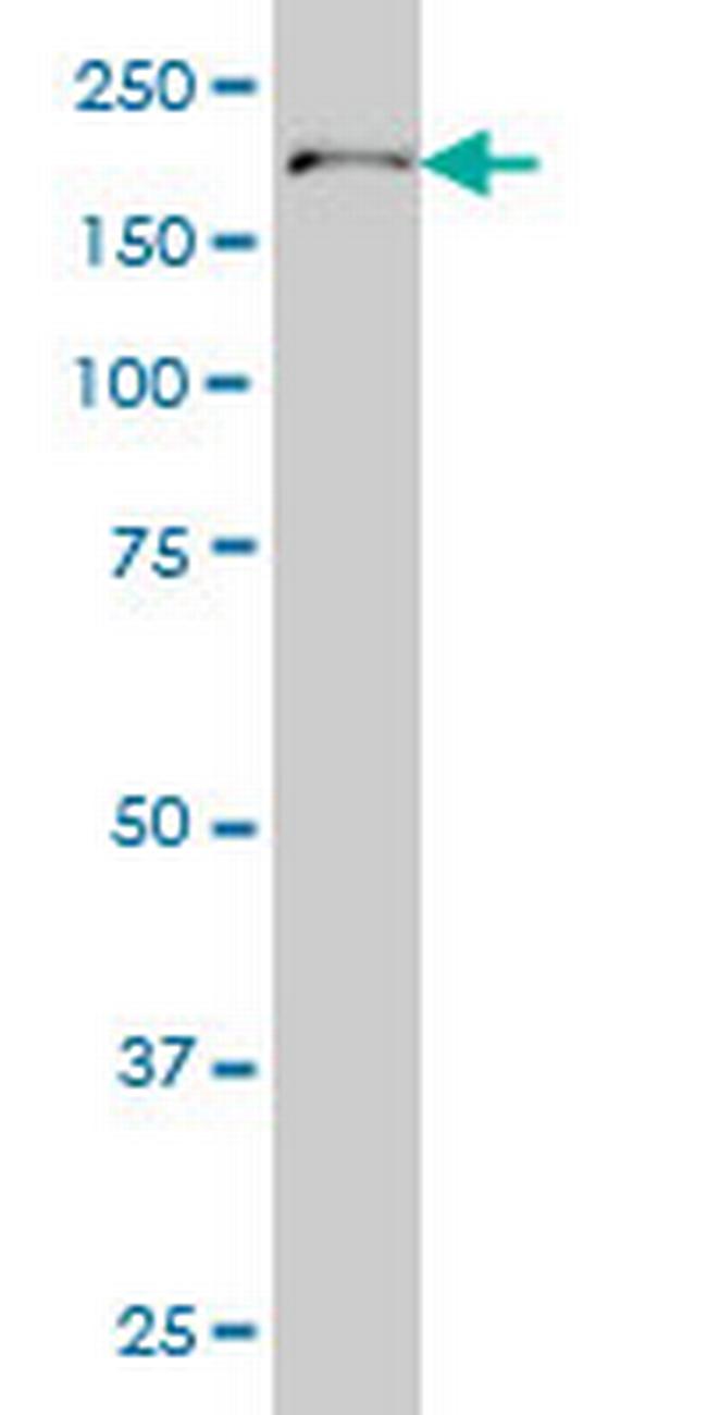 POLA Antibody in Western Blot (WB)