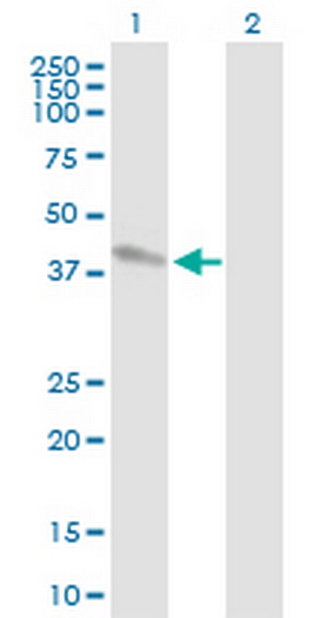 POLB Antibody in Western Blot (WB)