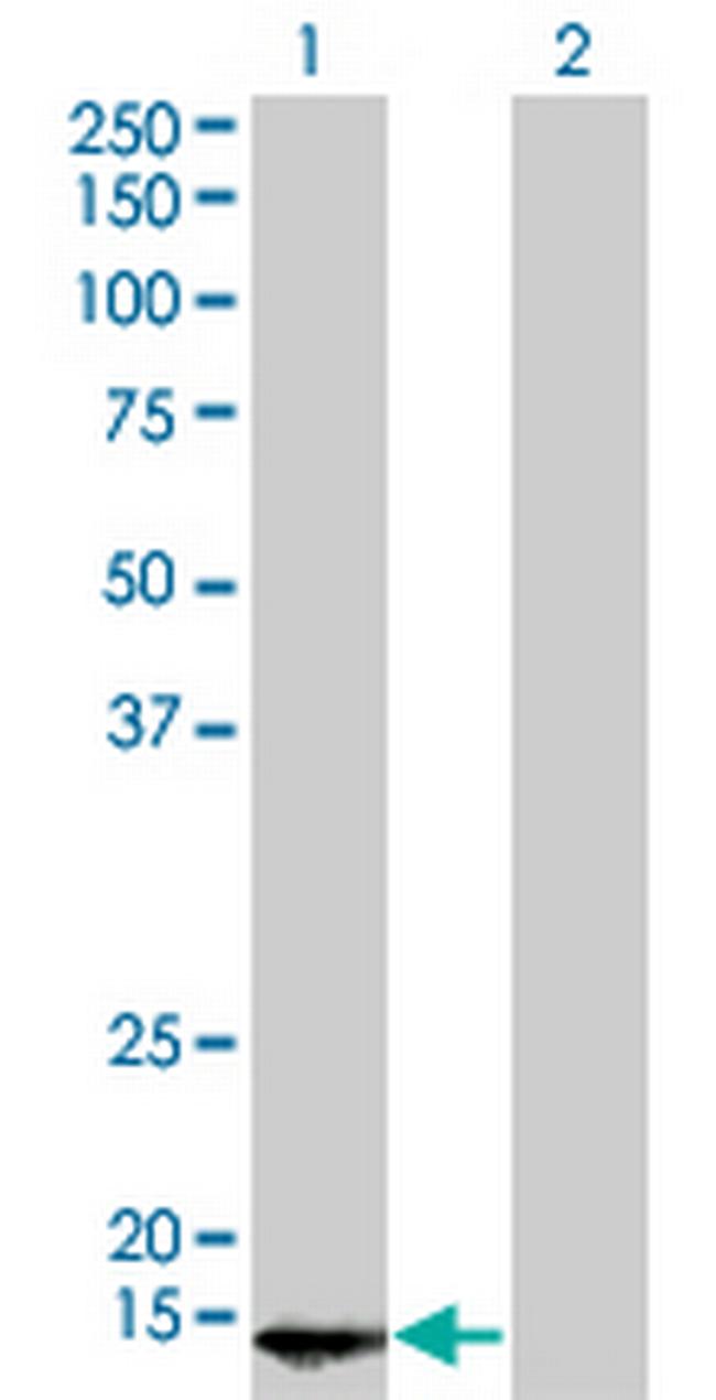 POLR2D Antibody in Western Blot (WB)