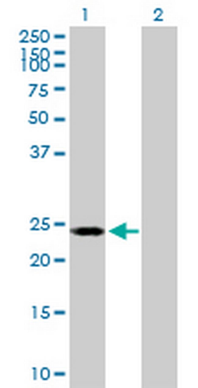 POLR2E Antibody in Western Blot (WB)