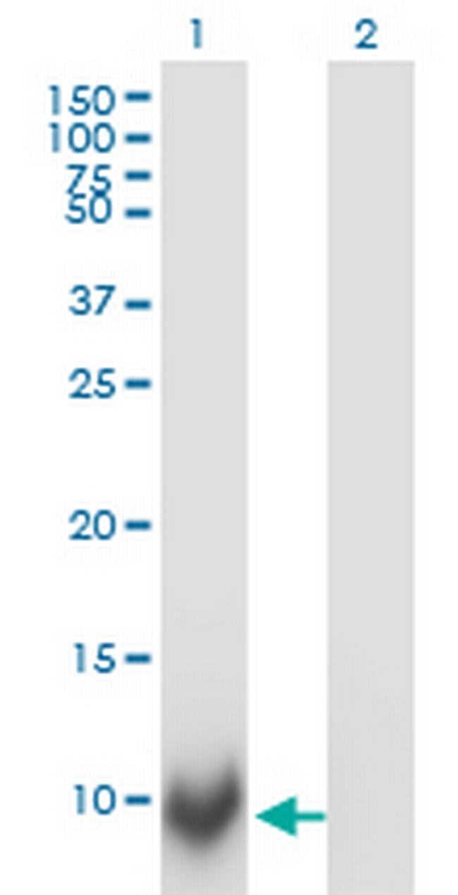 POLR2J Antibody in Western Blot (WB)