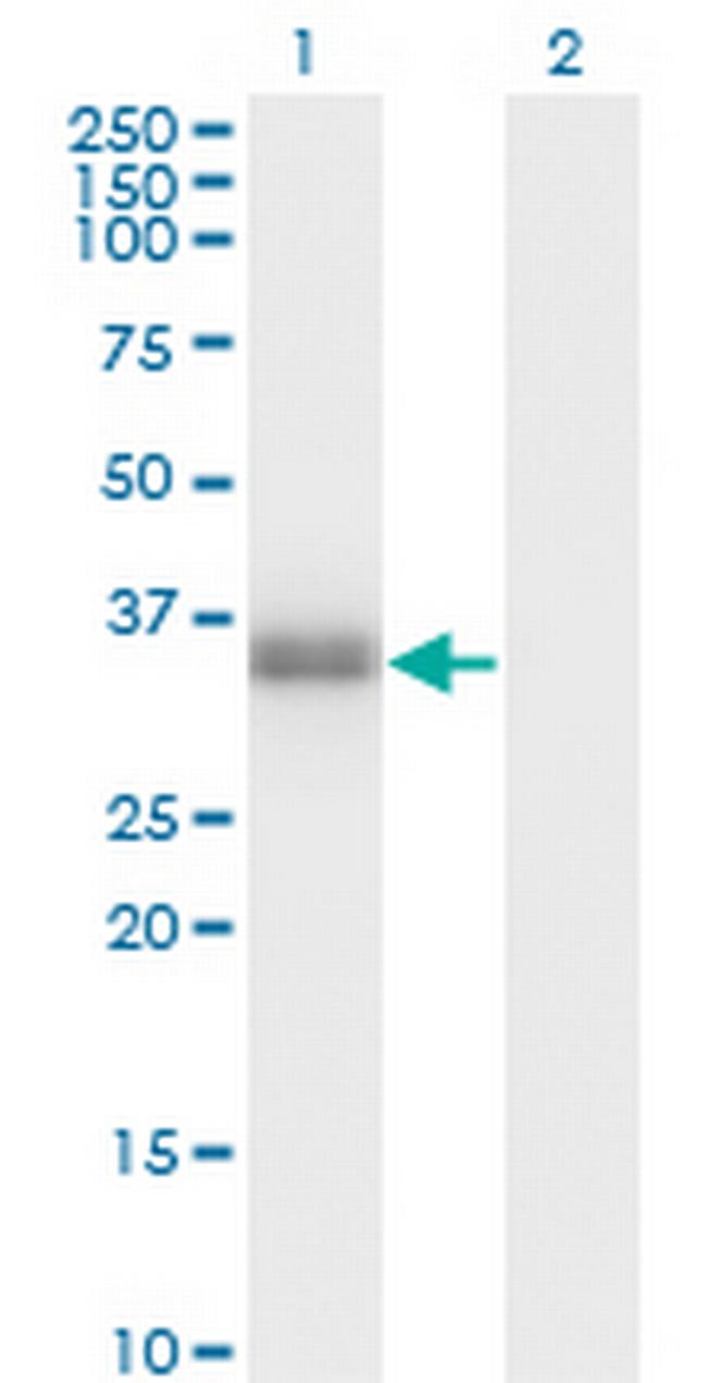 POMC Antibody in Western Blot (WB)