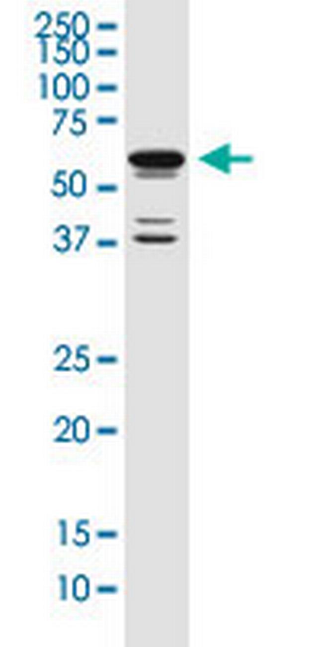 POU3F2 Antibody in Western Blot (WB)