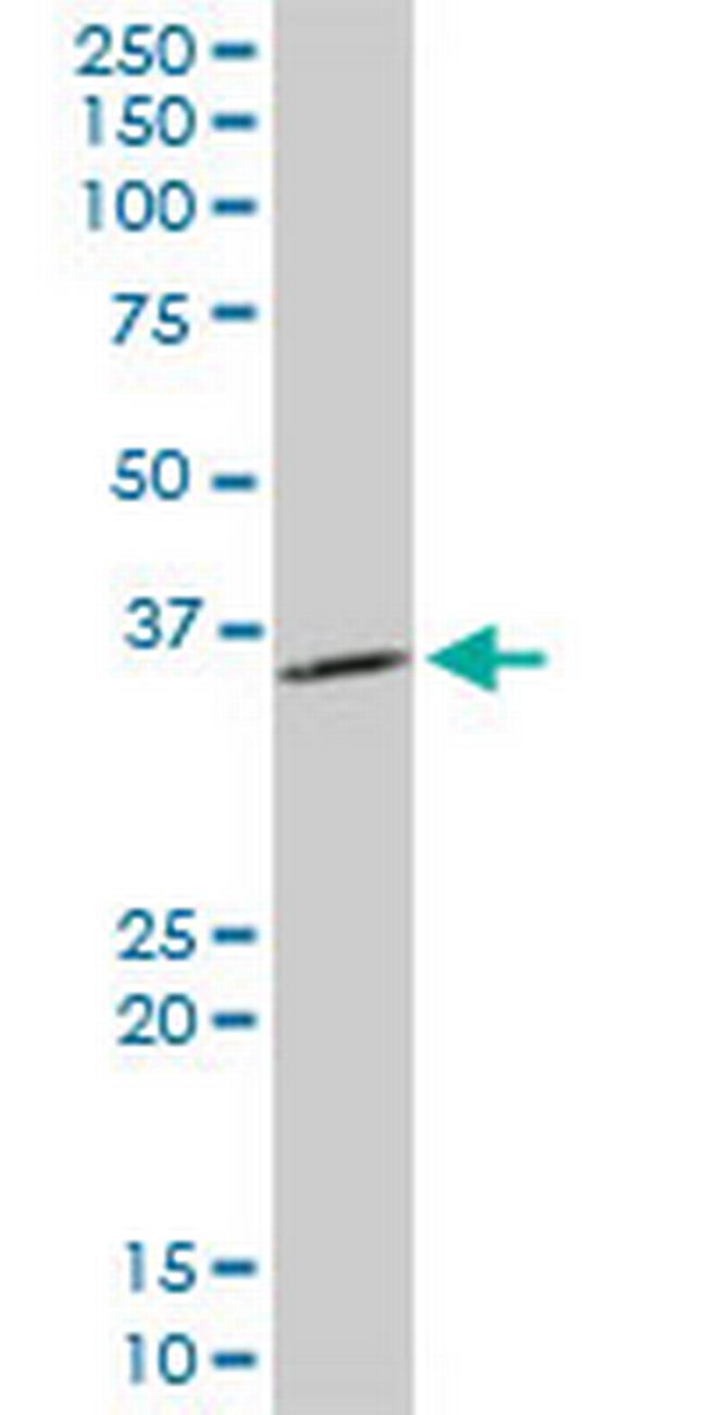 PPA1 Antibody in Western Blot (WB)