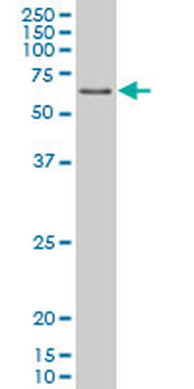 PPARD Antibody in Western Blot (WB)