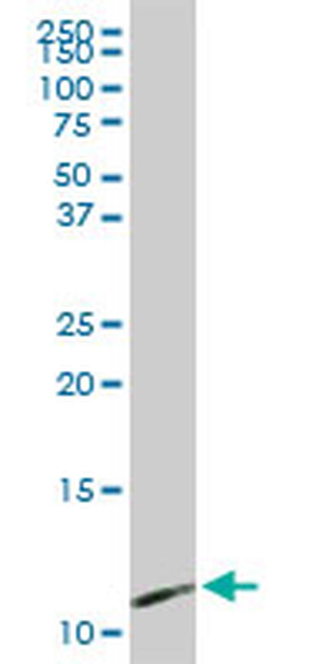 PPBP Antibody in Western Blot (WB)