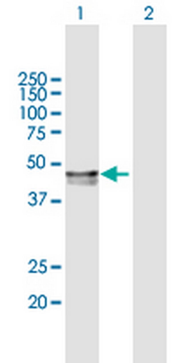 PPM1A Antibody in Western Blot (WB)