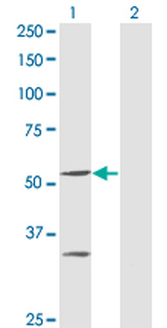 PPOX Antibody in Western Blot (WB)