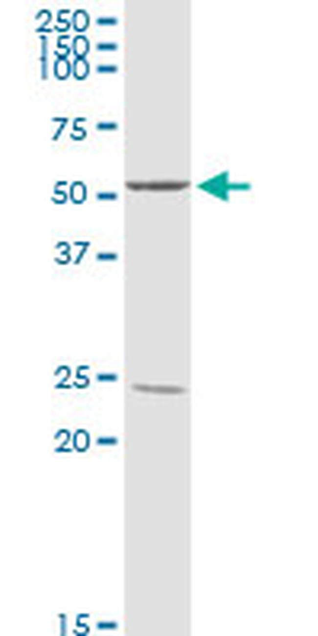 PPP2R2B Antibody in Western Blot (WB)