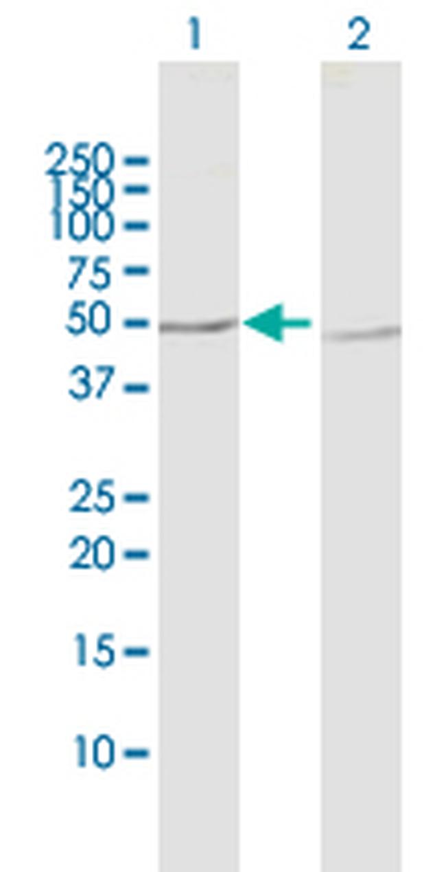 PPP2R2B Antibody in Western Blot (WB)