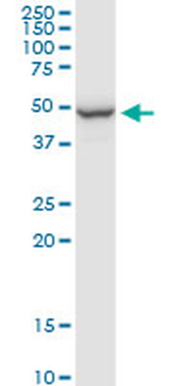 PPP2R2B Antibody in Western Blot (WB)