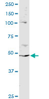 PPP2R2B Antibody in Immunoprecipitation (IP)